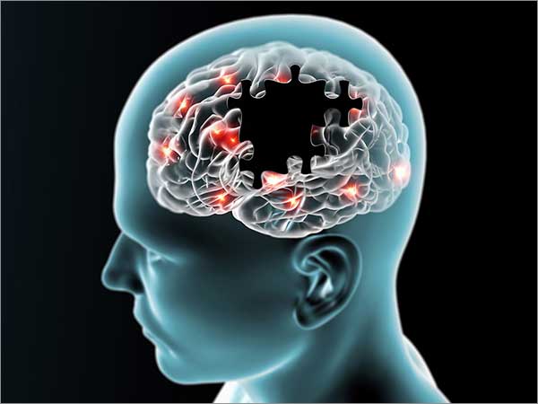 Homeopathic solutions for Nerve Disorders